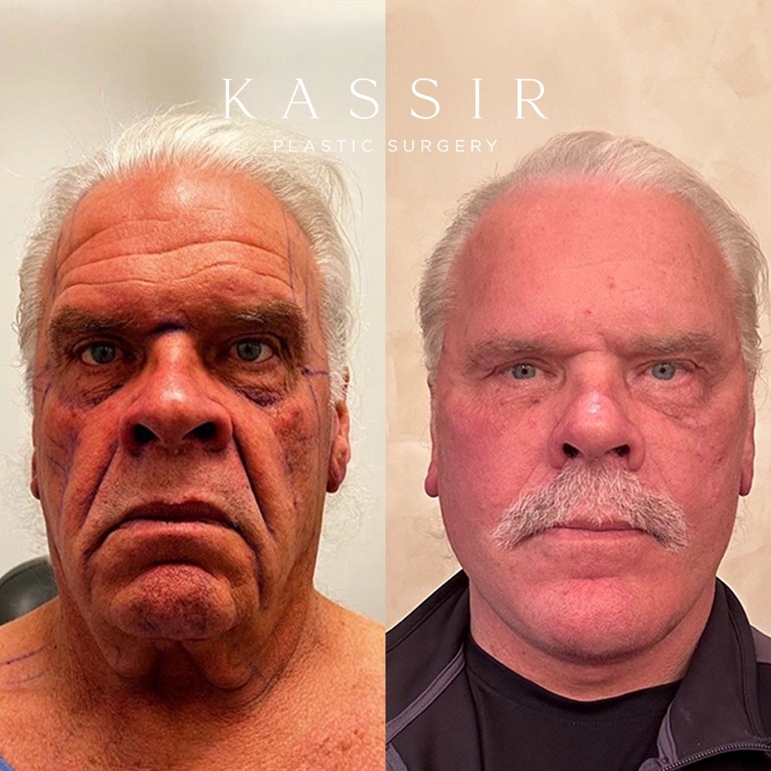 male before and after (2)