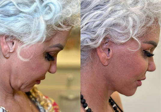 1_0001_1_0007_7facelift-3.png-768×768