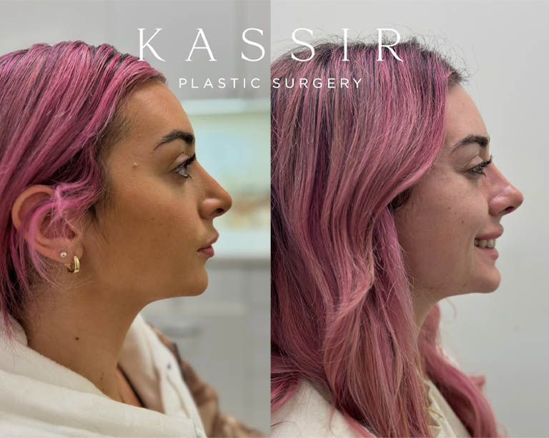 Untitled design – 1