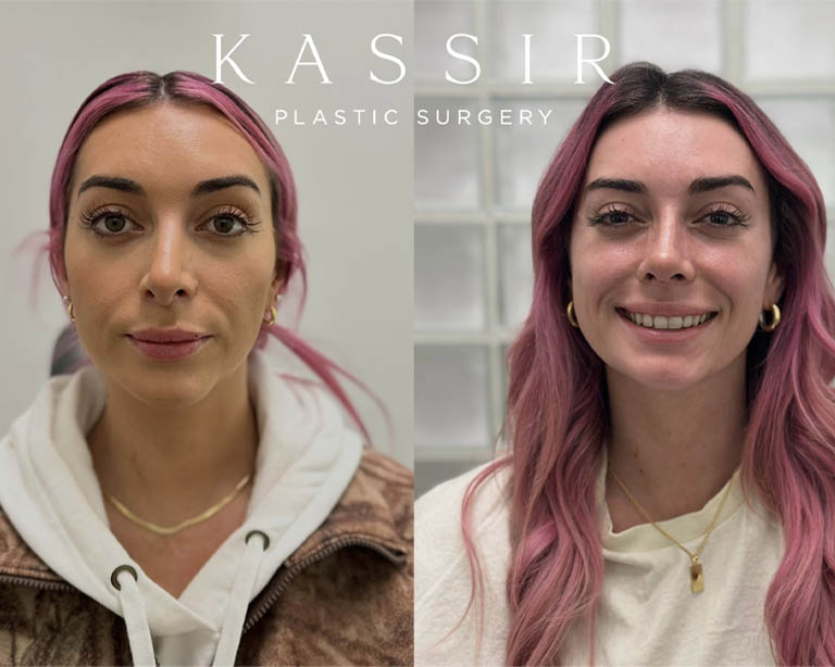 Untitled design – 1