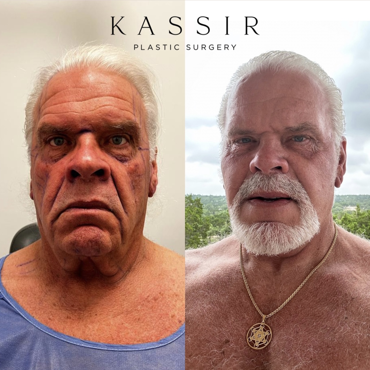 8E294F4F-298D-4AB0-BB52-70A6DFF0245E