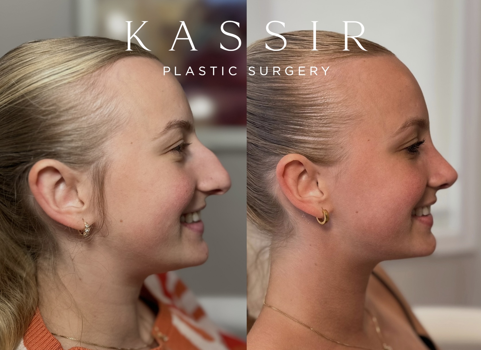 Simulation only – results may vary. 2