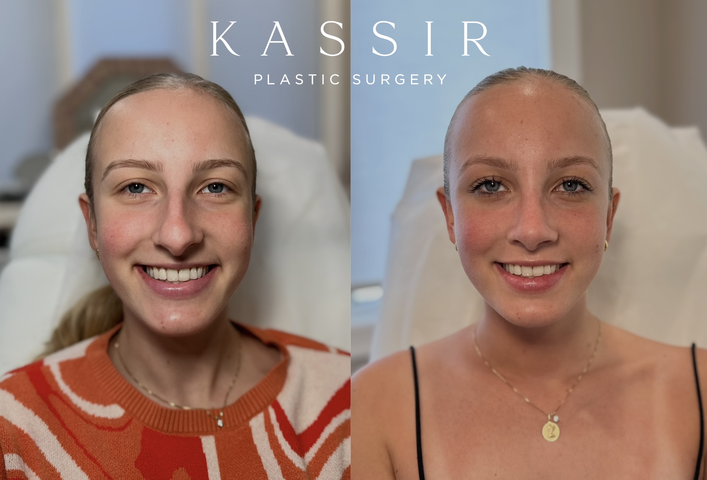 Simulation only – results may vary. 3