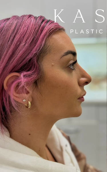 Untitled design – 1