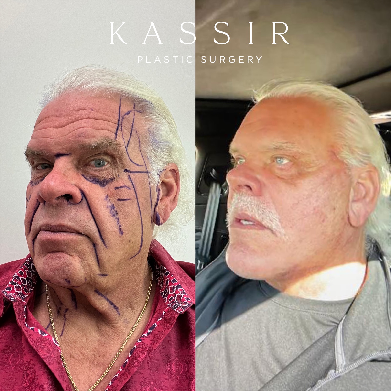 eZy Watermark_17-02-2023_02-33-19PM