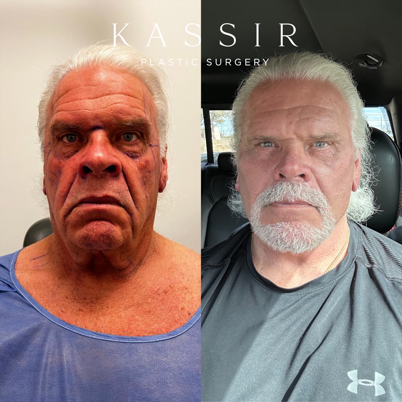 eZy Watermark_22-03-2023_10-24-16AM