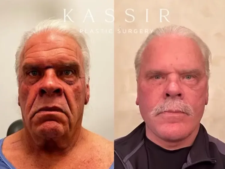 ba-video-thumb