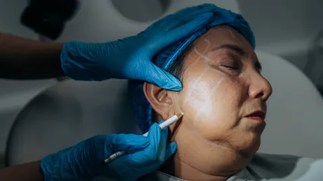 people-woman-facelift